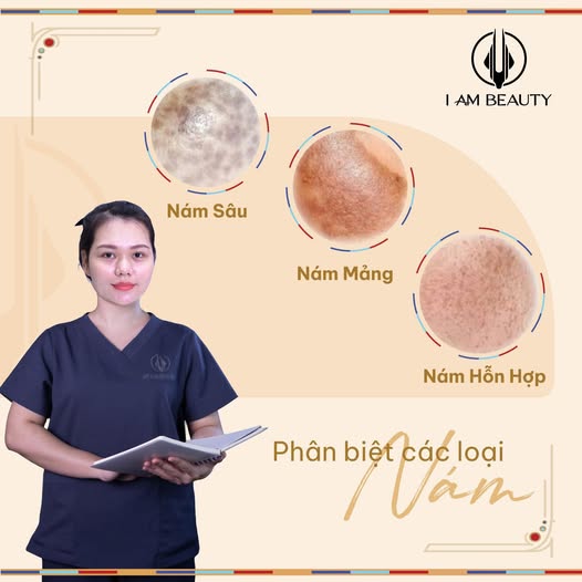 I Am Beauty - Phân loại các loại da nám