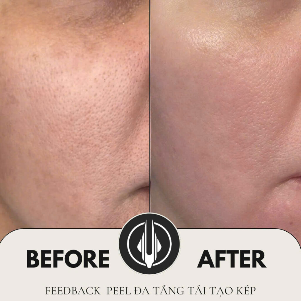 Khám phá vẻ đẹp thật sự của làn da cùng IAM BEAUTY BIÊN HOÀ