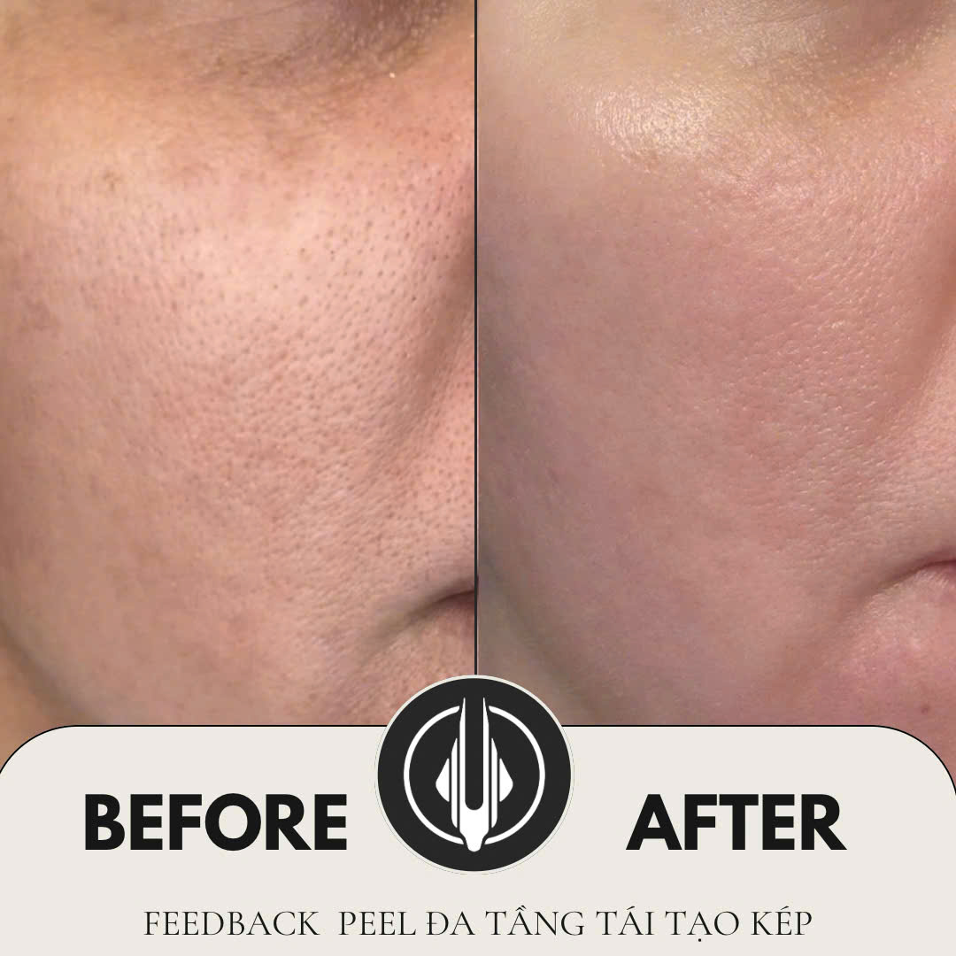 Khám phá vẻ đẹp thật sự của làn da cùng IAM BEAUTY BIÊN HOÀ