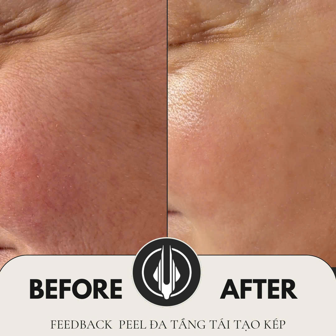 Khám phá vẻ đẹp thật sự của làn da cùng IAM BEAUTY BIÊN HOÀ