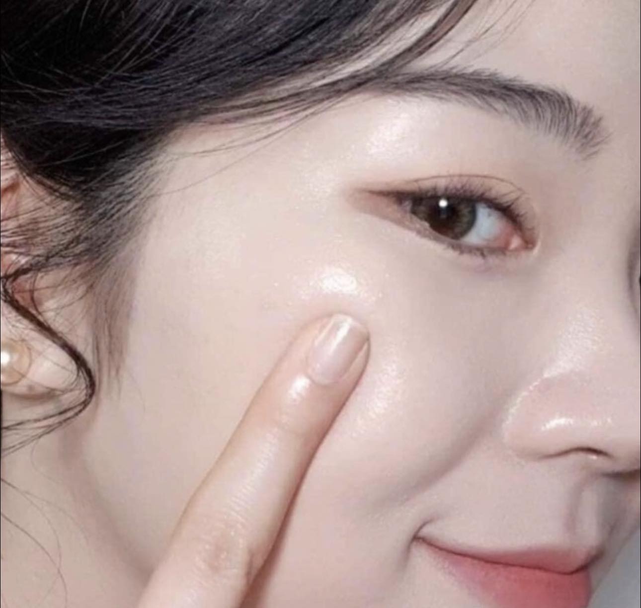 Da bị di tắc mụn xỉn màu